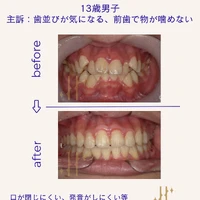 画像537