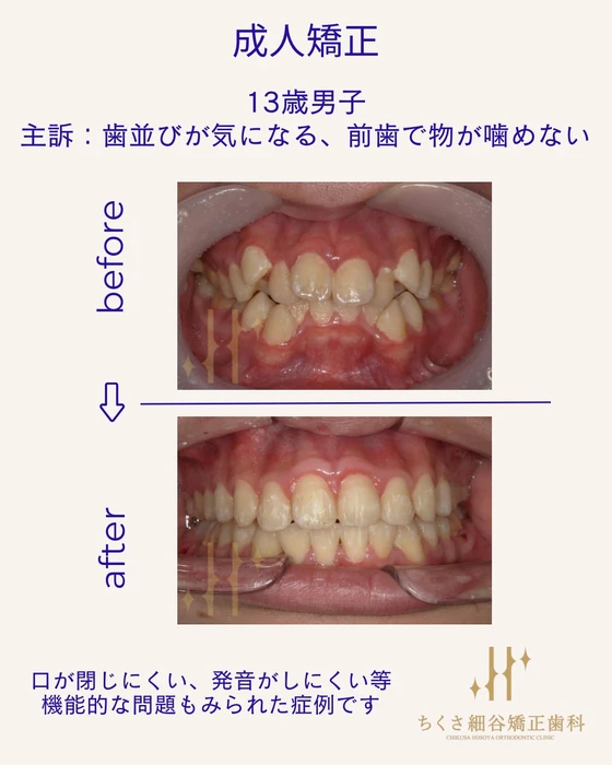 画像537