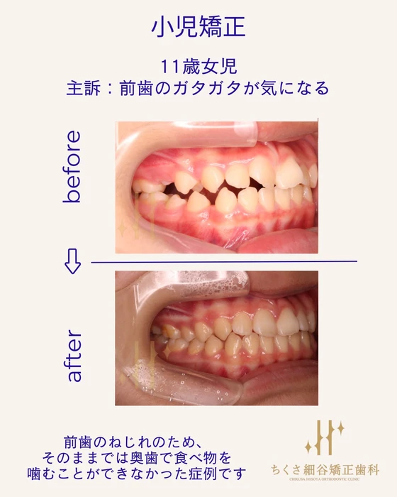 画像556