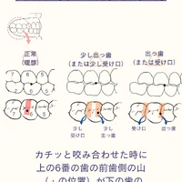 画像612