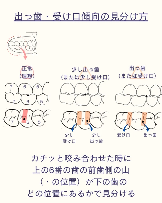 画像612