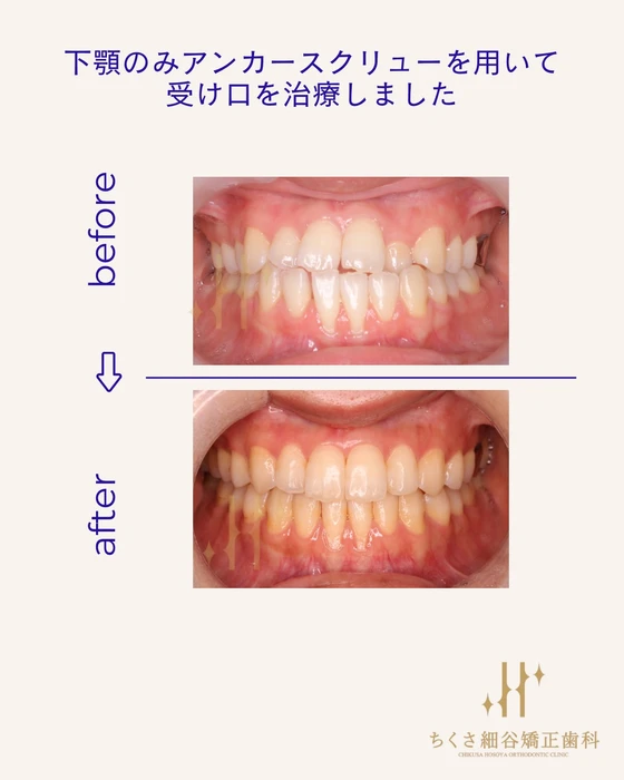 画像622